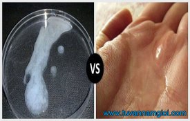 [TP.HCM] Phân tích tinh trùng loãng có mang thai được không?